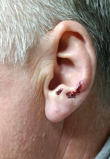 «Махровые националисты»: в Кисловодске неизвестные всадники отхлестали плетками местных пенсионеров