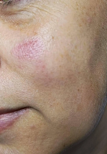 «Махровые националисты»: в Кисловодске неизвестные всадники отхлестали плетками местных пенсионеров