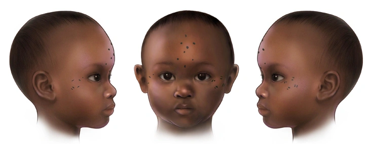 PNAS: 1400 лет назад нубийцы начали делать младенцам татуировки на лице